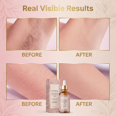 Cyperus Rotundus Oil