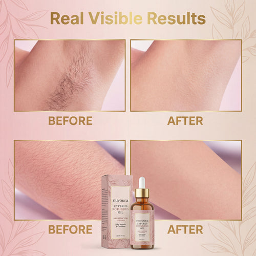 Cyperus Rotundus Oil